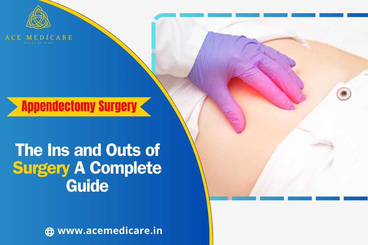 The Ins and Outs of Appendectomy Surgery: A Complete Guide
